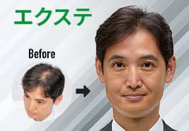 部分的に増やしたい