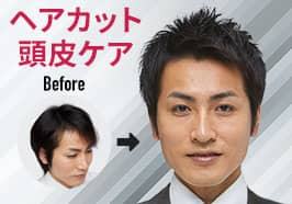 抜け毛・薄毛が気になる