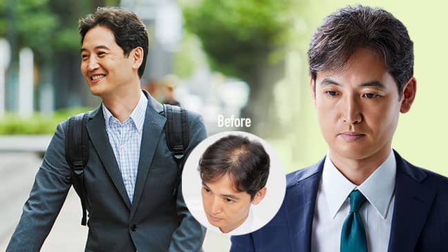 スヴェンソン「マイヘアプラス」